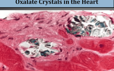 Oxalates: A Hidden Cause of Pain, Anxiety, and Chronic Inflammation