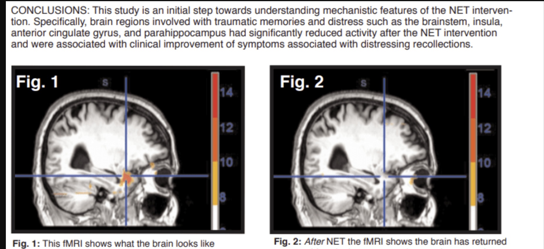 MRI NET