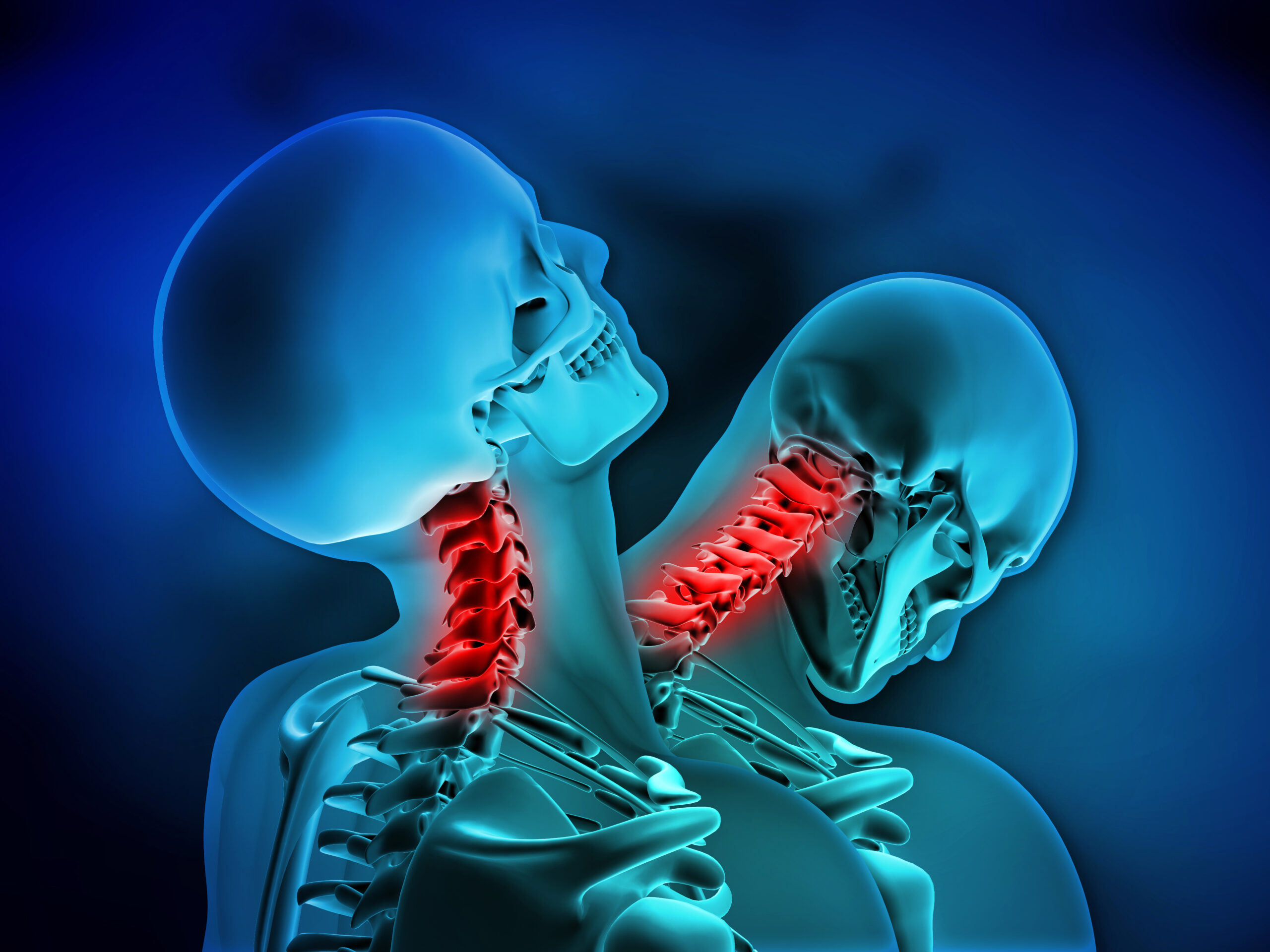 Whiplash,,Neck,Injury