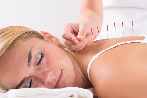 ss-acupuncture-blond (2)